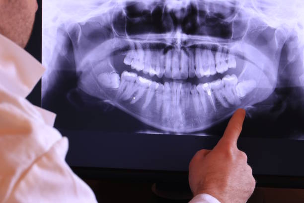 Best Emergency Dental Services for Seniors in San Bruno, CA